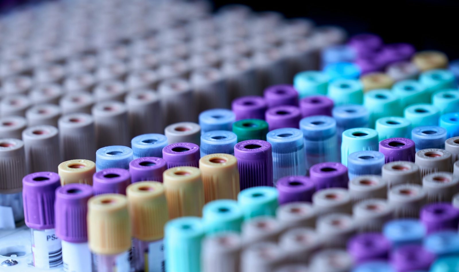 Rows of blood collection tubes with purple, blue, teal, yellow and beige caps standing in a laboratory rack, with the back rows out of focus